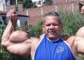 Addio ad Arlindo de Souza &ldquo;Anomalia&rdquo;, morto a 55 anni per insufficienza renale e liquido nei polmoni il bodybuilder dai muscoli con Synthol