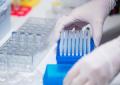 Usa, aumenta uso testosterone donne 40-60 anni, Fda avverte: "Possibili effetti avversi anche permanenti: perdita di capelli e ingrossamento clitoride"