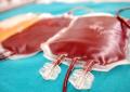 Ancona, buttati 6 quintali di sangue dall'ospedale Torrette, 1600 sacche di plasma nella spazzatura per negligenze organizzative