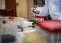 Covid Italia, avanza variante Stratus: tornano i 'vecchi' sintomi