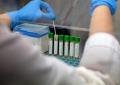 Medicina, italiani svelano errori nascosti nelle cellule: "Possibile ruolo in più malattie"
