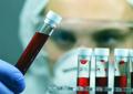 Salute, da Fedemo appello per autosufficienza nazionale sangue e plasmaderivati
