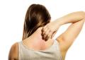 Dermatite atopica, raccolta firme per inserirla in Piano cronicità e Lea
