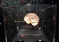 Medicina, neurologi: "L'innovazione può cambiare la storia di molte malattie ma serve equità"