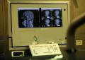 Medicina: Congresso Sin, neurologia tra innovazione, responsabilità e nuova organizzazione
