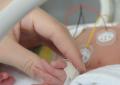 Torino, neonata di 6 giorni salvata con colla istantanea da rara malformazione vascolare al fegato che "rubava" sangue al corpo, congestionando cuore e polmoni