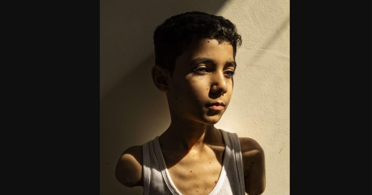 Gaza, il REPORT Unicef: "Oltre 64mila bambini sono stati uccisi o mutilati nella Striscia, inclusi 1000 neonati, fame continua a dilagare"