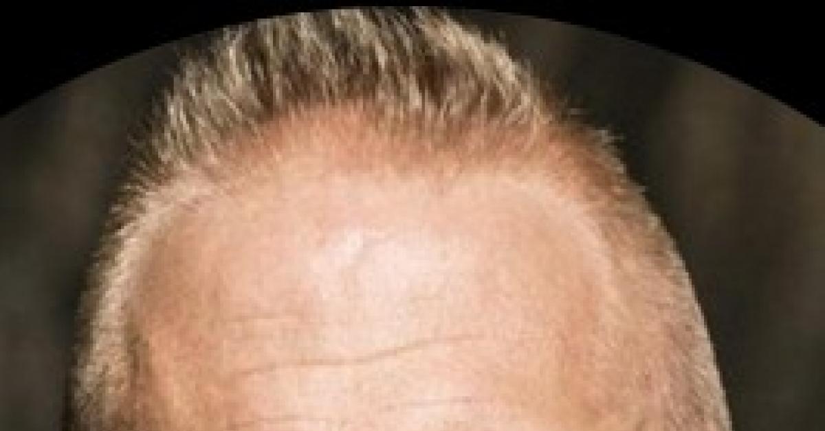 Usa, Parscale, ex responsabile campagna elettorale Trump, assunto da Israele come agente straniero: contratto da 6mln$ per "contrastare antisemitismo"