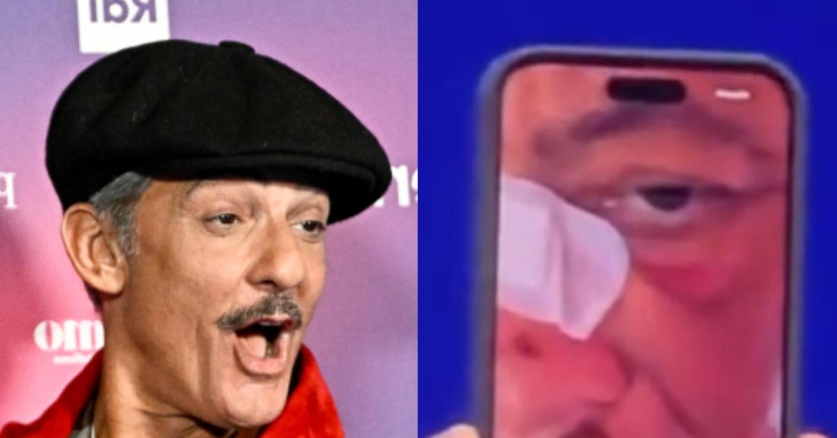 Incidente in bici per Fiorello: "Sono caduto di faccia, ho usato il freno davanti in una lunga discesa che porta al secondo cancello"   VIDEO Incidente in bici per Fiorello: "Sono caduto di faccia, ho usato il freno davanti in una lunga discesa che porta al secondo cancello"   VIDEO