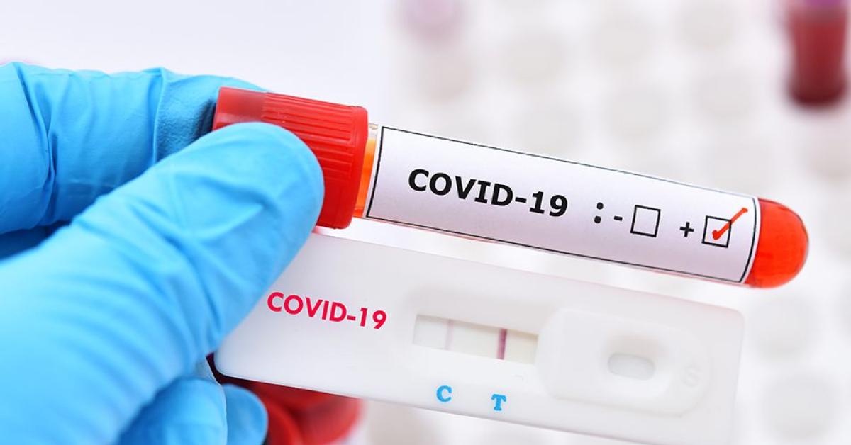 Covid, biologi tedeschi: "L