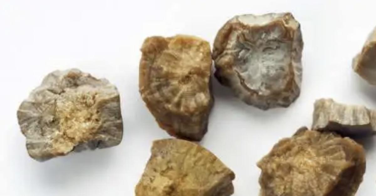 Ladri rubano "pepite" in casa, ma erano calcoli renali appena analizzati: "derubato" l Ladri rubano "pepite" in casa, ma erano calcoli renali appena analizzati: "derubato" l