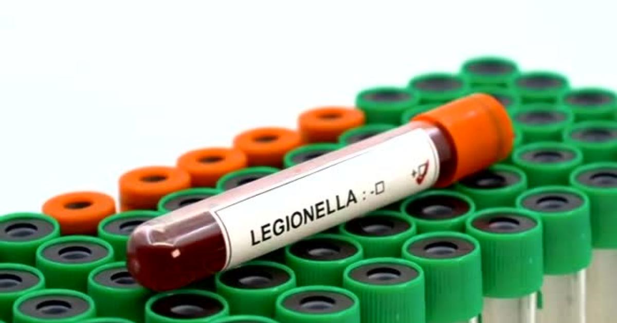 milano sospetto focolaio di legionella nel quartiere san siro 1 morto e 8 ricoverati ats avvia campionamenti nelle abitazioni a rischio da Ilgiornaleditalia.it milano sospetto focolaio di legionella nel quartiere san siro 1 morto e 8 ricoverati ats avvia campionamenti nelle abitazioni a rischio
