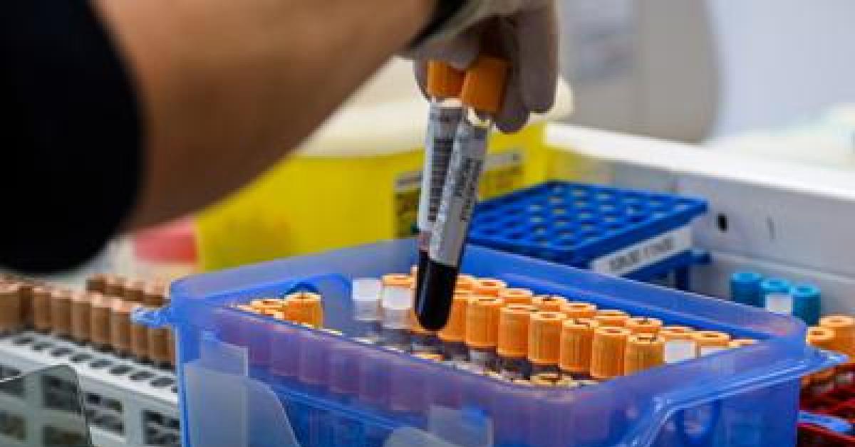 Fegato, un test per scoprire il rischio di gravi malattie entro 10 anni: lo studio
