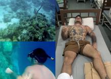 Luigi Favoloso morso da 'serpente marino velenoso' mentre fa snorkeling nelle Filippine: "Ho sentito come un ago perforarmi la pelle" - VIDEO