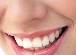 La crisi colpisce gli italiani fino... ai denti