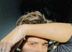 Michele Merlo, cantante ex “Amici” in gravi condizioni per emorragia cerebrale 