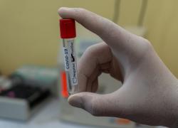 Origine Covid, ritrovate le sequenze del virus cancellate dai ricercatori cinesi 
