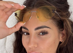 Giulia De Lellis acne incontrollabile, ma ora ha trovato la vera cura. Annuncio sui social