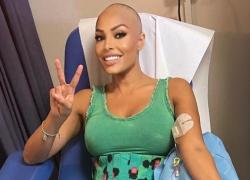 Chi è Carolina Marconi: tumore, Instagram, figli, marito e come sta 