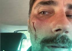 Brumotti aggredito a Foggia. Picchiato perché documentava il degrado della droga