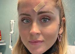 Valentina Ferragni in ospedale, ma nessuna malattia: solo un brufolo "sospetto"