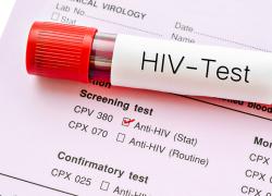 Aids: cause, cure e sintomi della malattia che ha segnato il XX secolo
