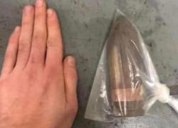 Proiettile da 17 centimetri nel sedere: uomo al pronto soccorso scatena il panico 