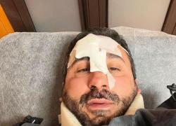 Natale Giunta, brutto incidente per lo chef de La Prova del Cuoco