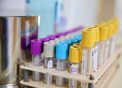 Omicron, studi britannici rilevano meno ricoveri per i casi di infezione: speranza per Europa e Italia