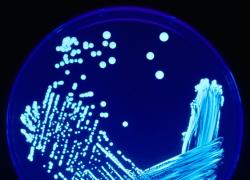 Cos'è la legionella: sintomi, malattia, si muore, trasmissione, polmonite, sistema immunitario