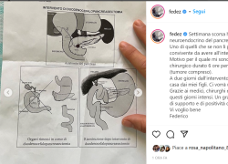 Cos'è il tumore neuroendocrino del pancreas, la malattia di Fedez: sopravvivenza, sintomi iniziali
