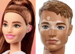 Barbie con apparecchio acustico e Ken con vitiligine: le nuove bambole della linea Fashionistas