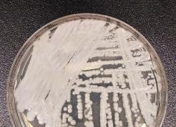 Candida Auris, il fungo killer si diffonde nel mondo: è letale dal 30% al 70%