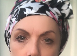 Chi è Rosanna Banfi, malattia, quanti anni ha d'età, marito, figli, altezza, Ballando con le Stelle con Simone Casula