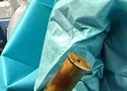 Ordigno incastrato nel retto, 88enne fa scattare l'allarme bomba: evacuato parzialmente ospedale di Tolone