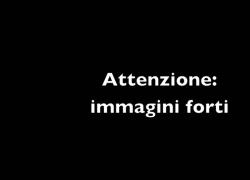 Usa, polizia uccide Keenan Anderson, cugino del fondatore del Black Lives Matter - il VIDEO
