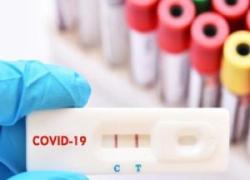 Truffa tamponi Covid, esposto del Codacons in Sicilia: “Fino al 95% di falsi positivi” - VIDEO da “Fuori dal coro” 