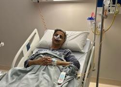 Beppe Convertini, incidente in moto a Roma: ha subito un delicato intervento chirurgico. "Ho la faccia distrutta"