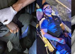 Catania, poliziotto colpito alla gola da extracomunitario: “mancata di poco la giugulare, vivo per miracolo”