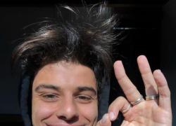 Michele Merlo, procura chiede archiviazione per il cantante morto di leucemia fulminante: "Medico non ha responsabilità"