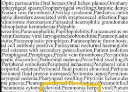 Polmoniti bambini Cina come reazione avversa a vaccino Covid: Mycoplasma Pneumoniae nel bugiardino Pfizer