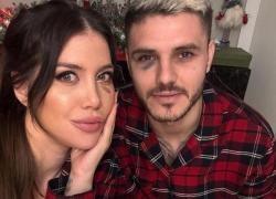 Icardi occhio nero nel derby di Istanbul e rissa social con l'avversario Dzeko