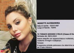 Alessandra Moretti, la moglie di Maurizio Battista ricoverata per embolia polmonare: "Sono viva per miracolo"