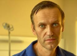 Navalny, ipotesi su causa morte: malore improvviso, trombo-embolia, infarto, avvelenato col Novichok
