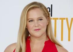 L'attrice Amy Schumer: "Ho la sindrome di Cushing, da qui il viso gonfio", la causa è l’eccesso dell'ormone cortisolo