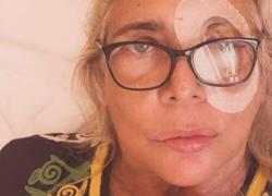 Mara Venier sull'intervento all'occhio: "Emorragia alla retina, ne devo fare altri 3, spero di riacquistare la vista"