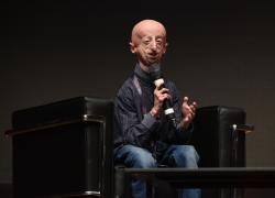 Addio a Sammy Basso, morto a 28 anni dopo un malore improvviso al ristorante il malato di progeria più longevo al mondo