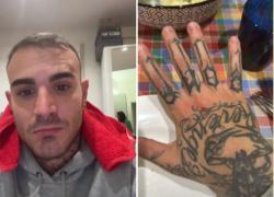 Il ginnasta Nicola Bartolini aggredito sotto casa: “Milano è una giungla, il ladro voleva portarmi via il cellulare ma l'ho preso a pugni” - VIDEO