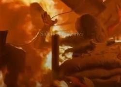 Gaza, palestinesi bruciati vivi da Idf all'ospedale al Aqsa a Deihr al Balah, 4 morti carbonizzati e 70 feriti - VIDEO CHOC