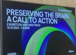 Quanti anni ha il nostro cervello?. Visto che non é possibile un lifting dei neuroni. Fondazione Prada inaugura  “Preserving the Brain: A Call to Action”, il progetto dedicato alla prevenzione delle malattie neurodegenerative.
